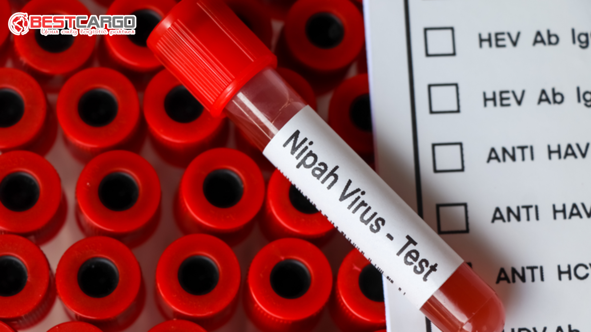 Sân Bay Tân Sơn Nhất Siết Chặt Phòng Chống Dịch Bệnh Nipah